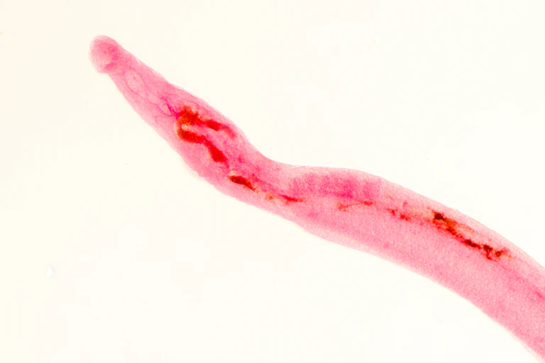 Microscopy image of the long, tubular worm that causes schistosomiasis against a white background