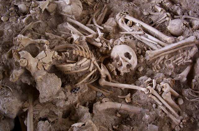 El éxito de la cirugía craneal en la prehistoria