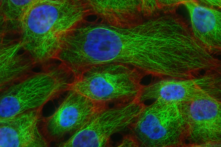 Cluster of cells with blue centre and fluorescent green fibres.