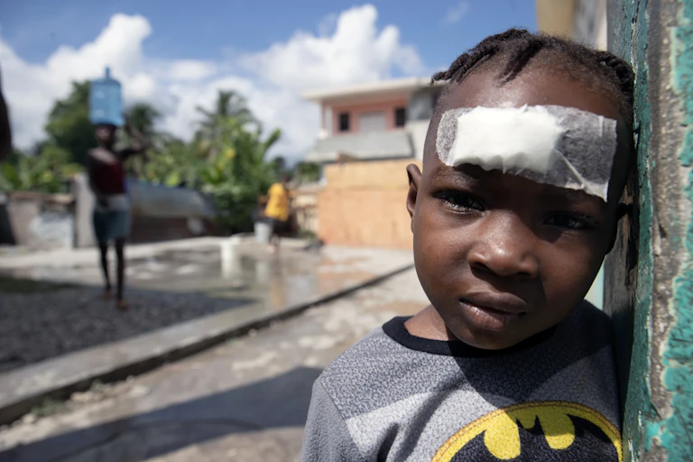 A Haitian child with a bandage across his forehead.