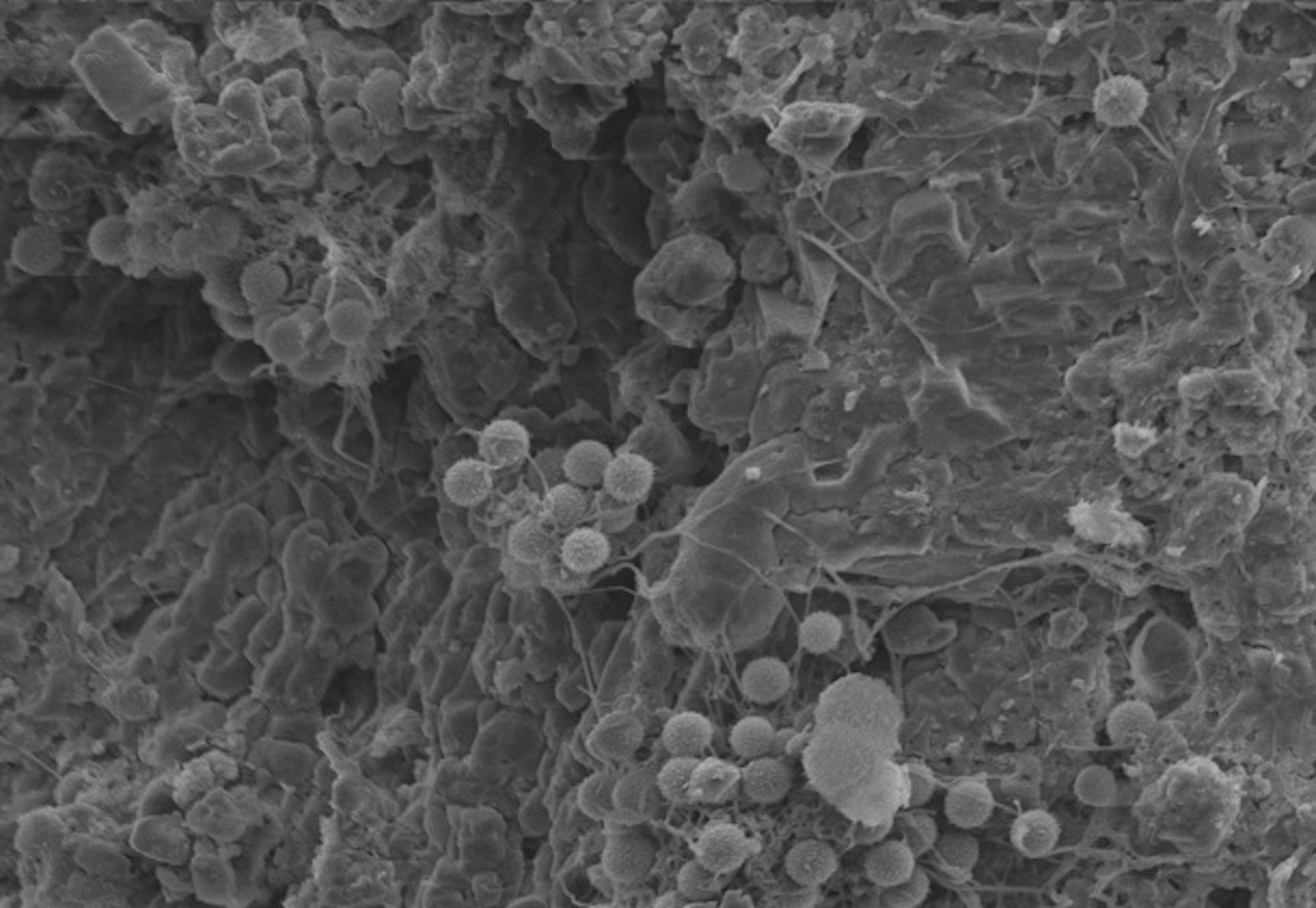 microorganismes au microscope