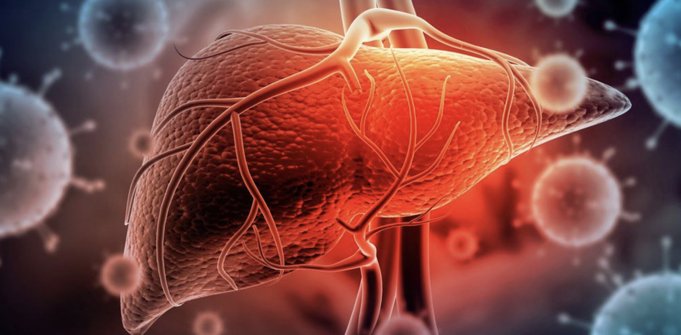 Esteatose hepática: como e por que o acúmulo de gordura no fígado se tornou uma epidemia global e preocupante