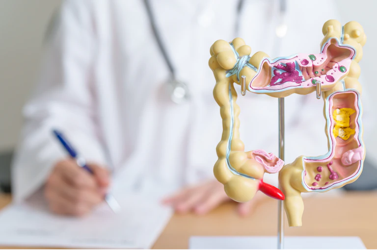 Photo d’un médecin avec en premier plan un modèle anatomique de colon.