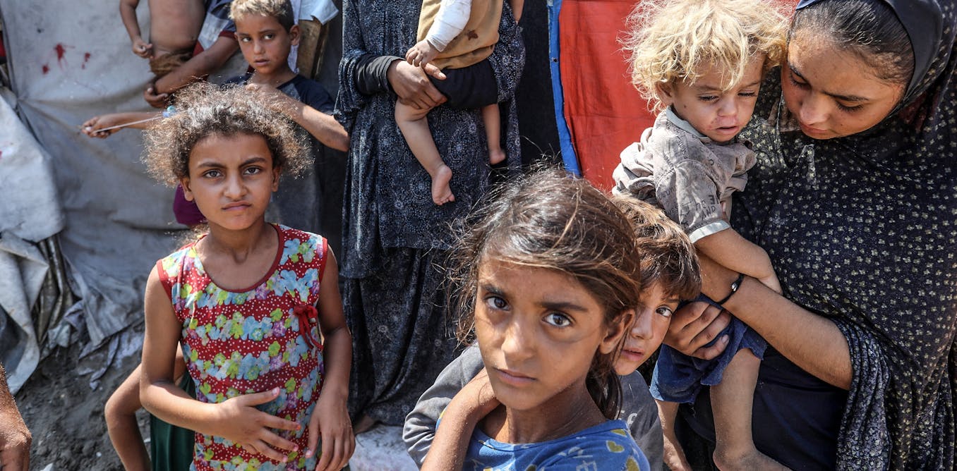 The UN warns famine is likely in Gaza. What do malnutrition and hunger do  to the body?