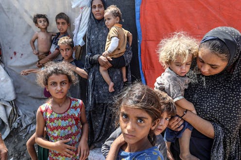 The UN warns famine is likely in Gaza. What do malnutrition and hunger do to the body?