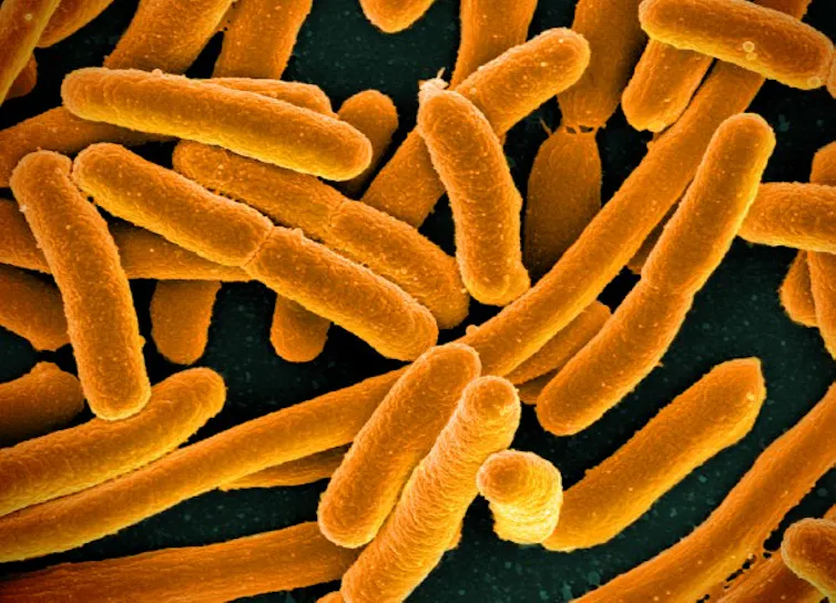 Microscopy image of rod-shaped E. coli, colored orange