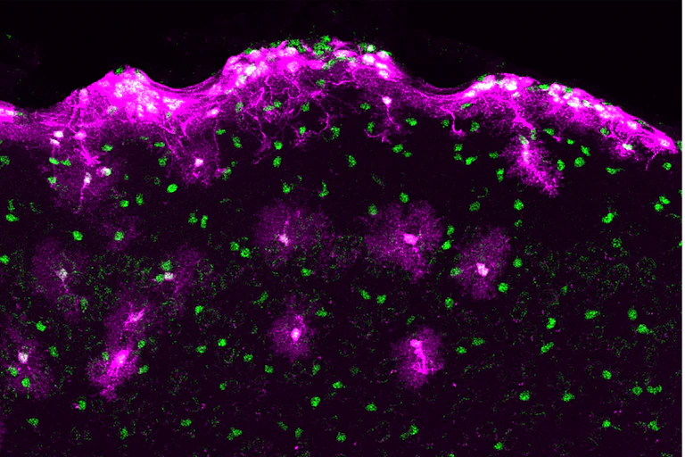 purple star-shaped cells against a black background with green dots