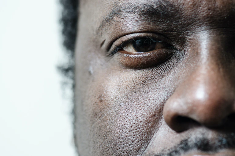 A close-up of a portion of an African man's face, his eye staring directly ahead, a small scar above it.