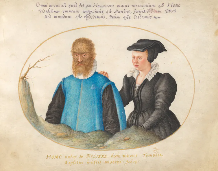 A detailed painting of a man and a woman standing next to one another in historical looking clothes. The man's face is covered in hair, while the woman's is not.
