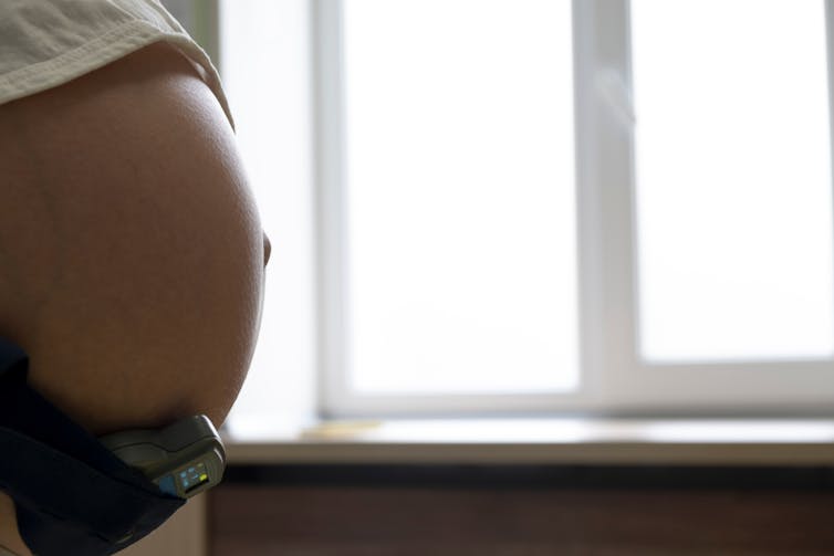 person's pregnant belly with wired monitoring attached
