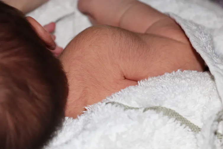 Fine hair is seen on a baby's back.