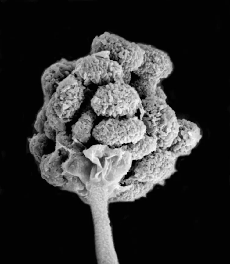The head of a fungus, zoomed in under a microscope.