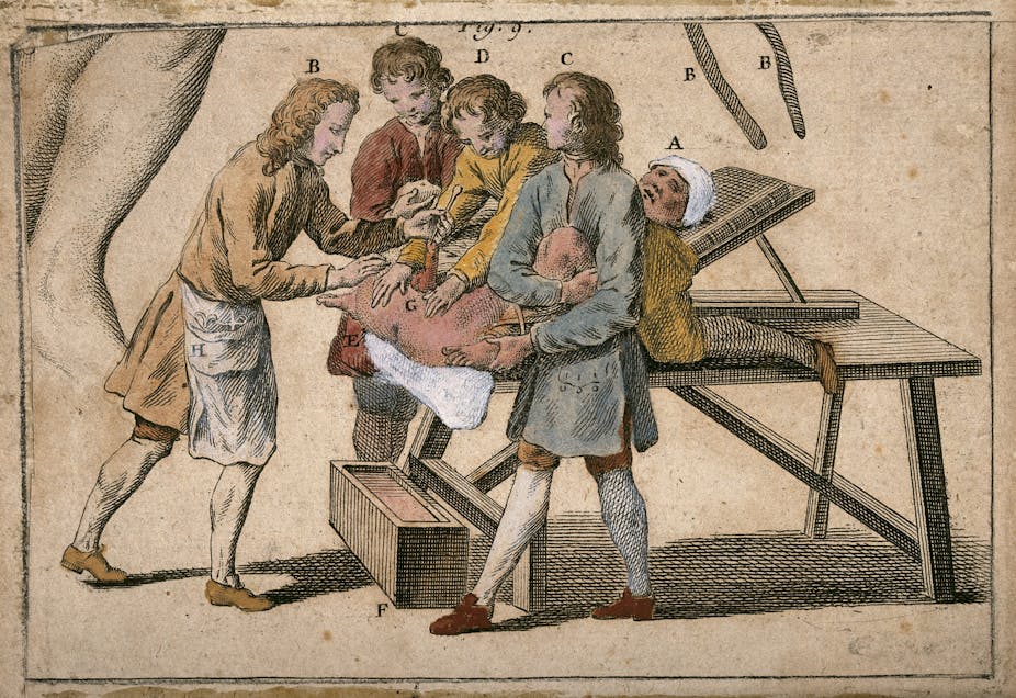 A surgeon performing a lithotomy on a patient