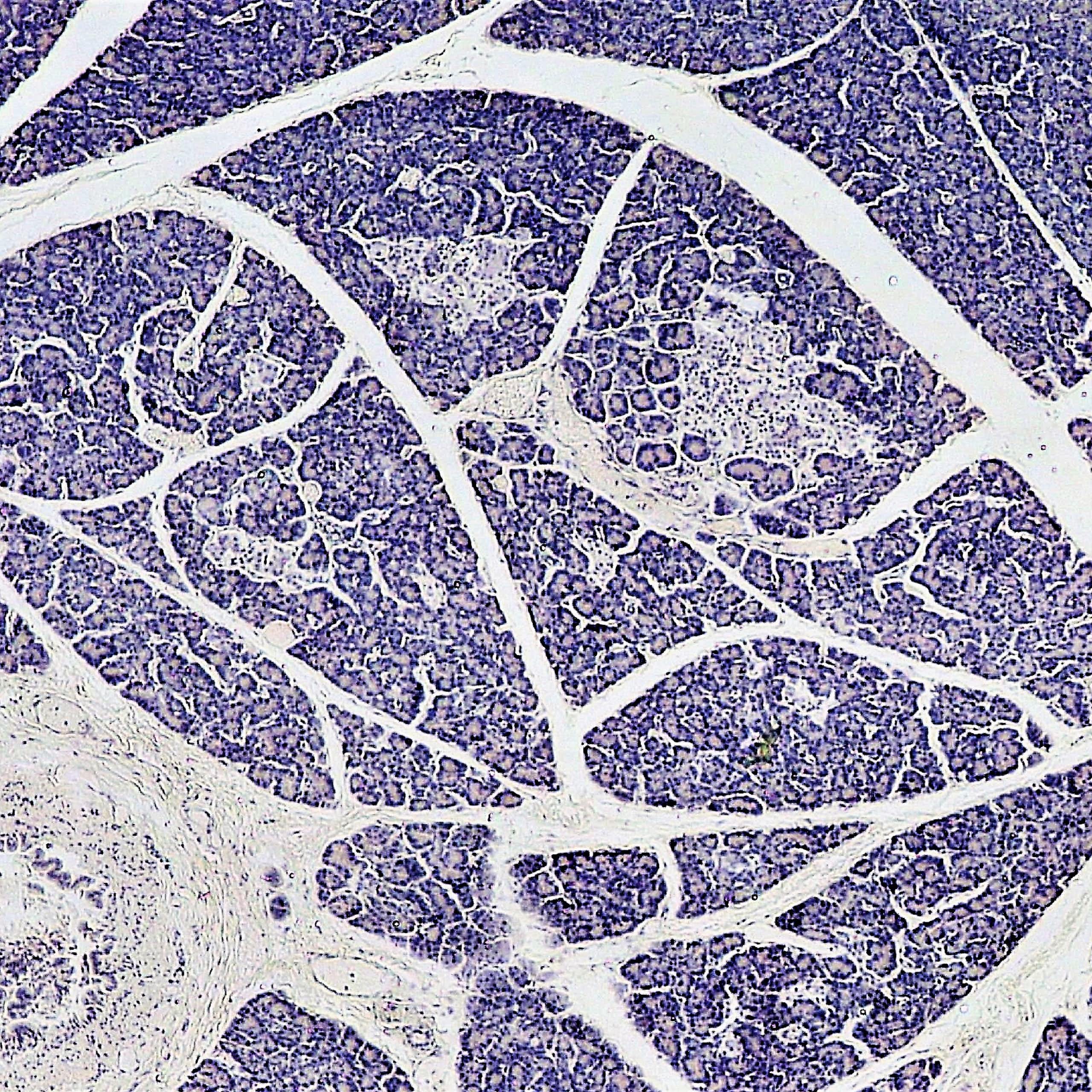 Microscopy image of branches and clumps of white threaded through grainy purple cells