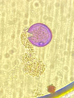 Microscopic photo of a pink circle broken at the side leaking small yellow dots.