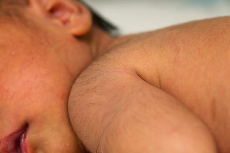 A baby has a lot of hair on their shoulder.