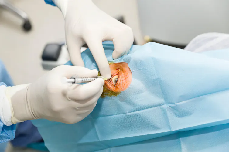 Patient receiving a local anaesthetic injection in the eye.