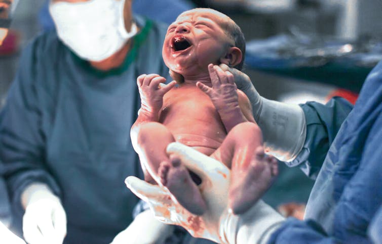 Crying newborn held in a clinician's gloved hands