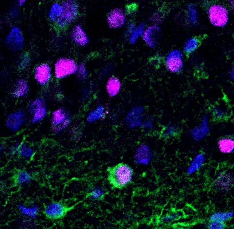 Microscopy image of green tendrils weaving between and around blue and purple blobs.