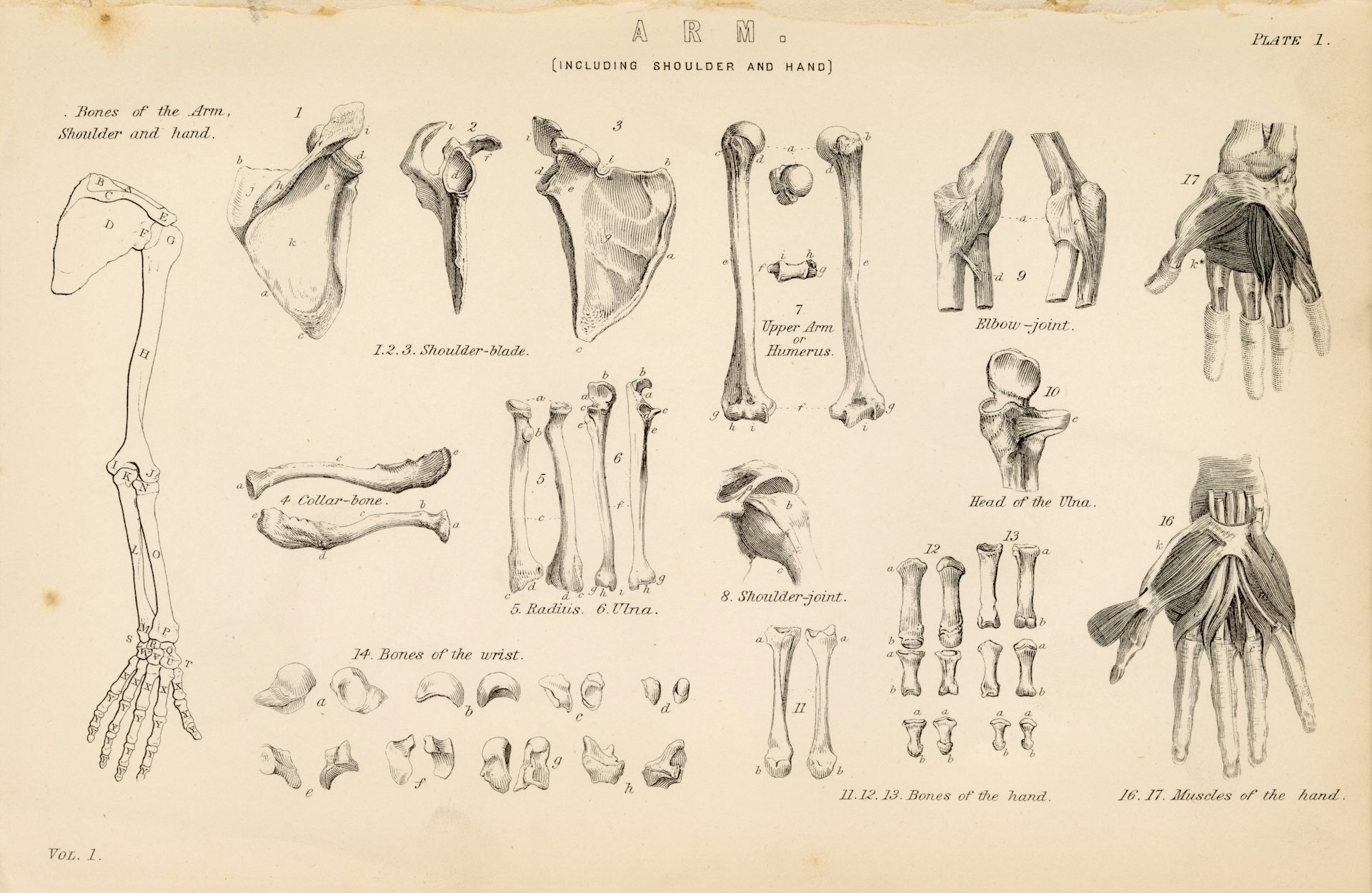 histories what fetal and baby remains in medical collections