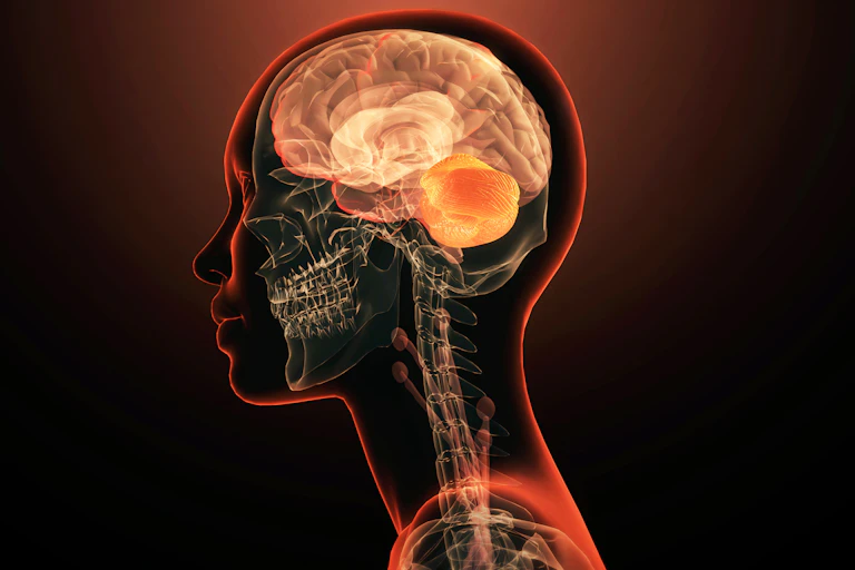 Illustration of a person's profile with their skeleton and inflamed brain visible
