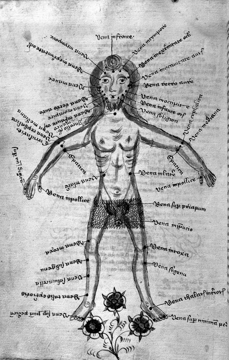 A schematic of a man.