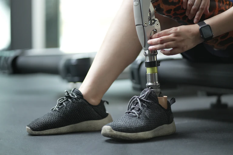 Person touching their prosthetic leg.