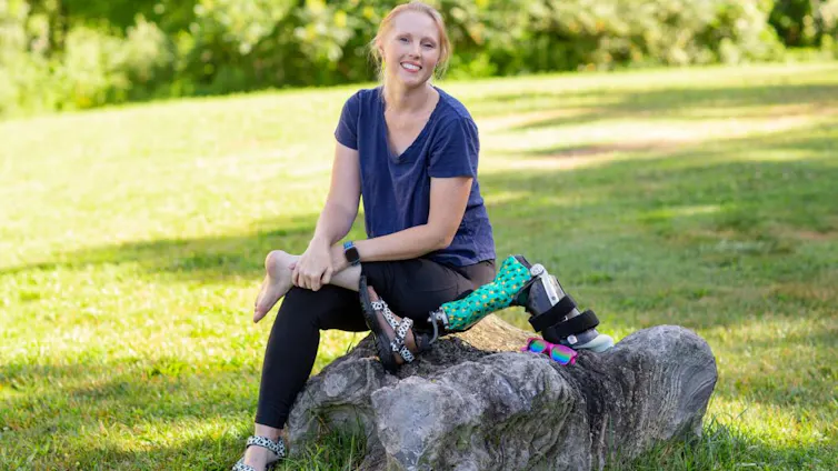 A smiling woman sits on a log with her artificial leg beside her.