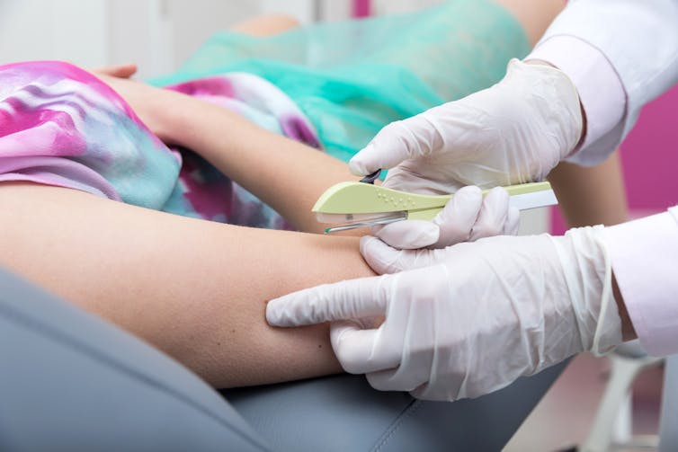A woman gets a hormonal birth control product implant