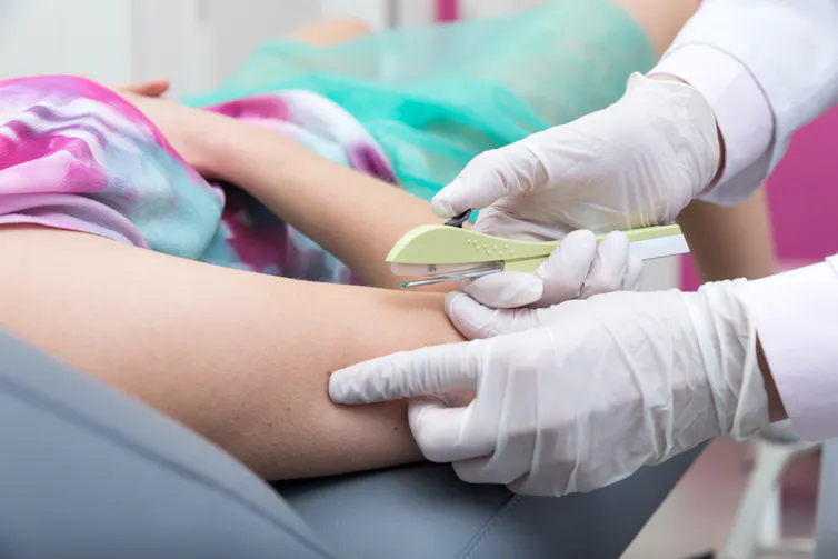Une femme se fait implanter un contraceptif hormonal