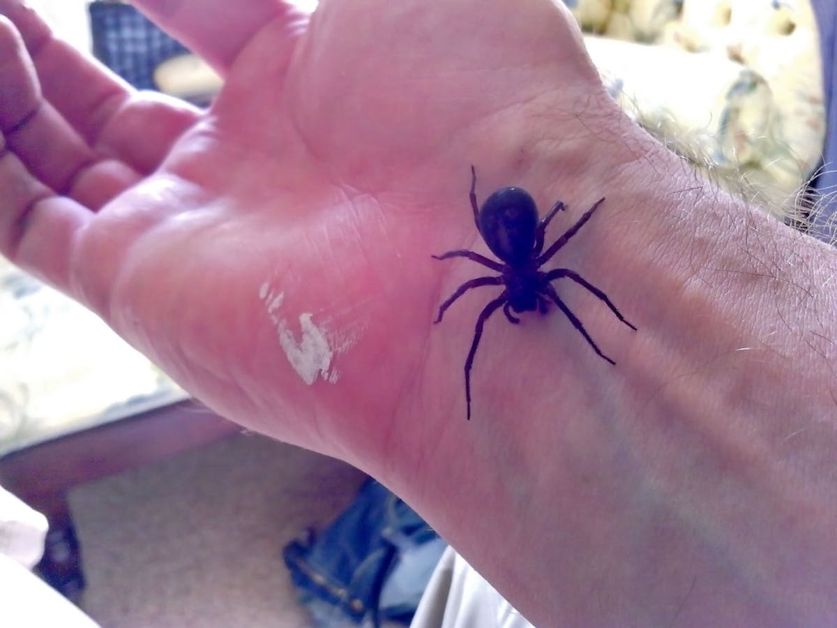 Black Widow Spider Bite Pictures - pic-nugget