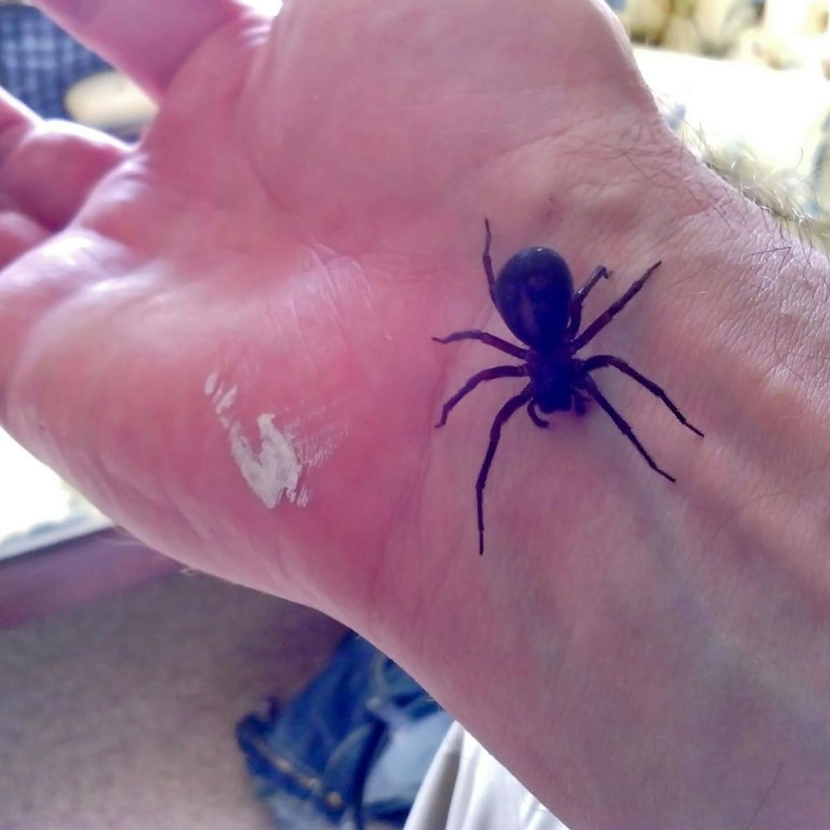 Black Widow Spider Bite Pictures - pic-nugget