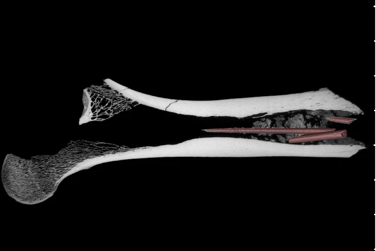 A 3D rendering of a femur bone.