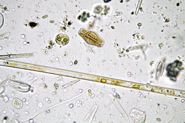 de très petits organismes cellulaires en vert clair et noir sur fond blanc