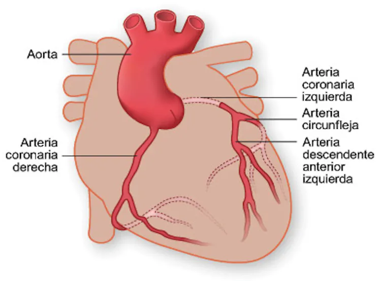 Arterias coronarias