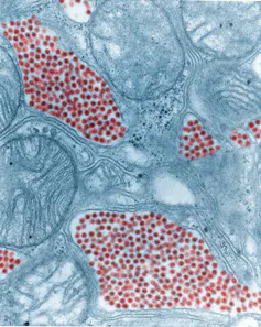 Microscopy image of oblong blobs filled with small red circles, surrounded by blue cicular blobs
