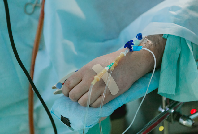 A hand with an intravenous port