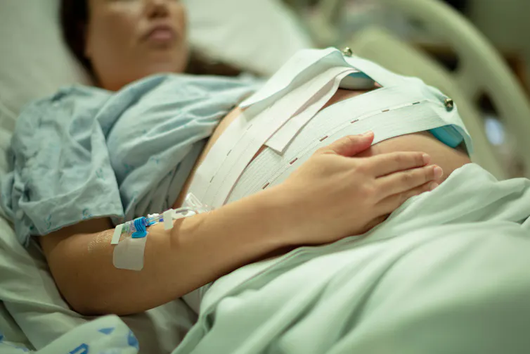 A pregnant woman in hospital with an IV and contractions monitor.