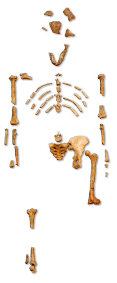 Bone and skull fragments.