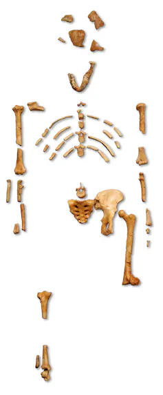 Bone and skull fragments.