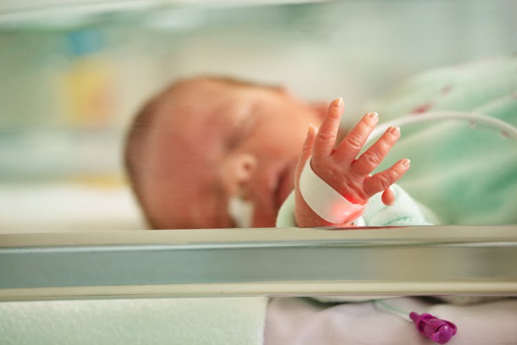 Newborn baby in hospital bassinet with extra finger