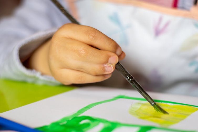 Child with syndactyly holding paint brush