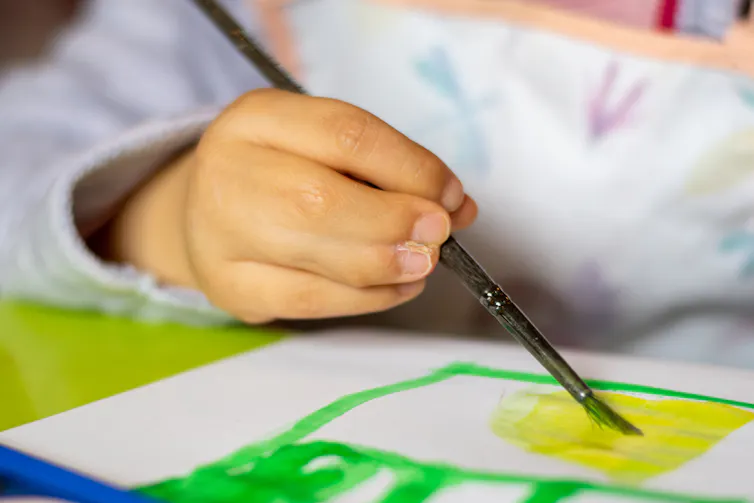Child with syndactyly holding paint brush