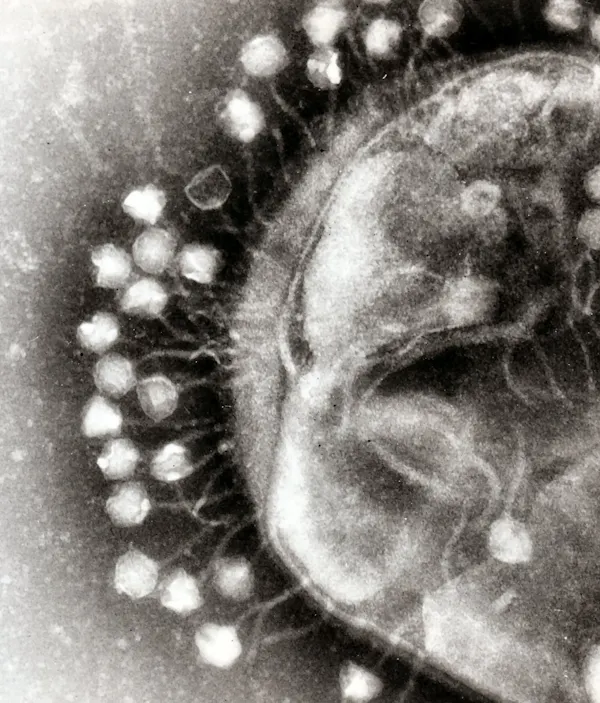 Imagen de microscopía de muchas bolas geométricas unidas a una esfera translúcida por hebras delgadas