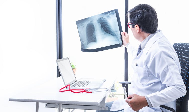 A doctor reviewing lung X-rays.
