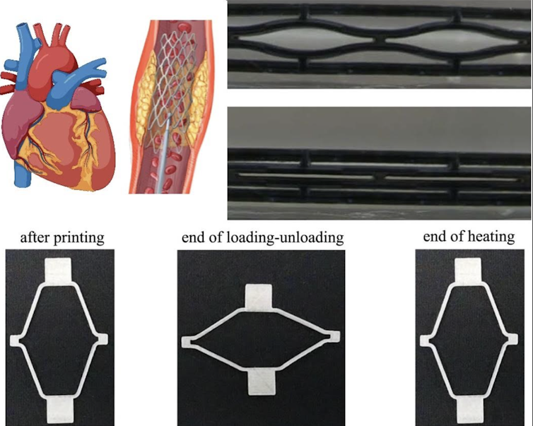 Diagrams of NTU's 4D-printed stent