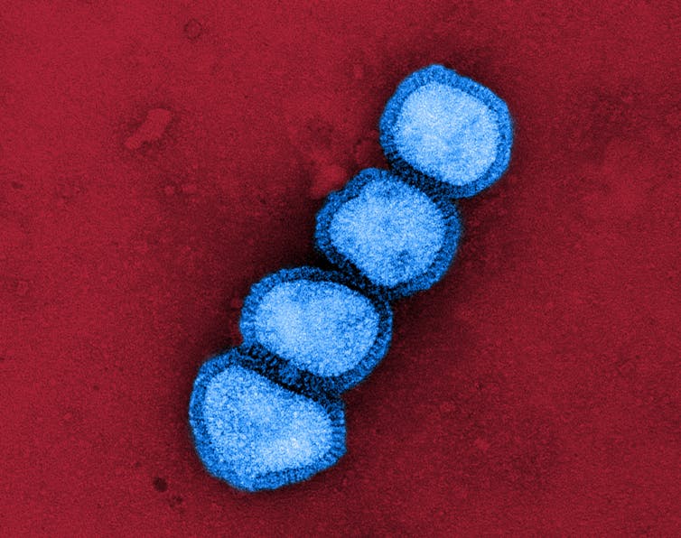 Micrographie électronique à transmission colorisée de particules du virus de la grippe A/H1N1.