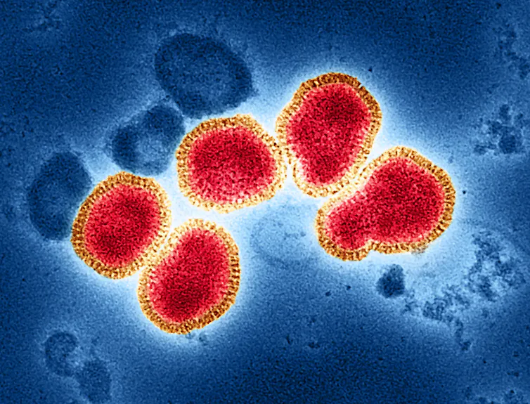 Micrographie électronique à transmission colorisée de particules du virus de la grippe A/H3N2 (rouge), souche isolée pour la première fois en 1975 chez un patient à Victoria, en Australie.