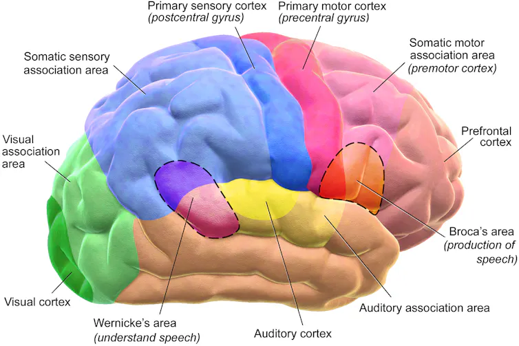 A labelled diagram of a brain, with a different colour representing each lobe.