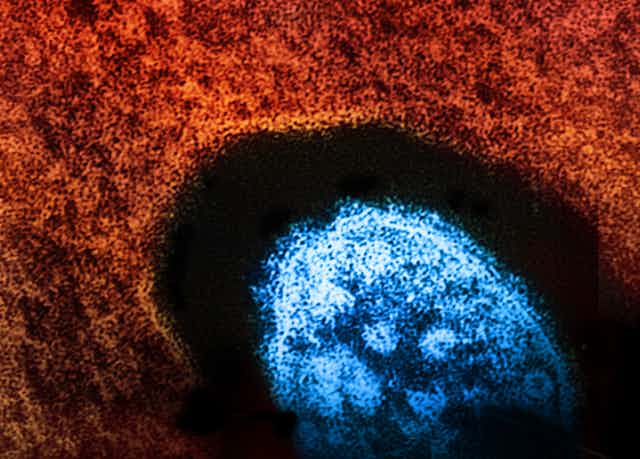 Colourized microscopic view of the measles virus in blue